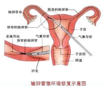 通草的功效与作用能通输卵管堵塞_最新热门解析实施_精英版232.3.169.165